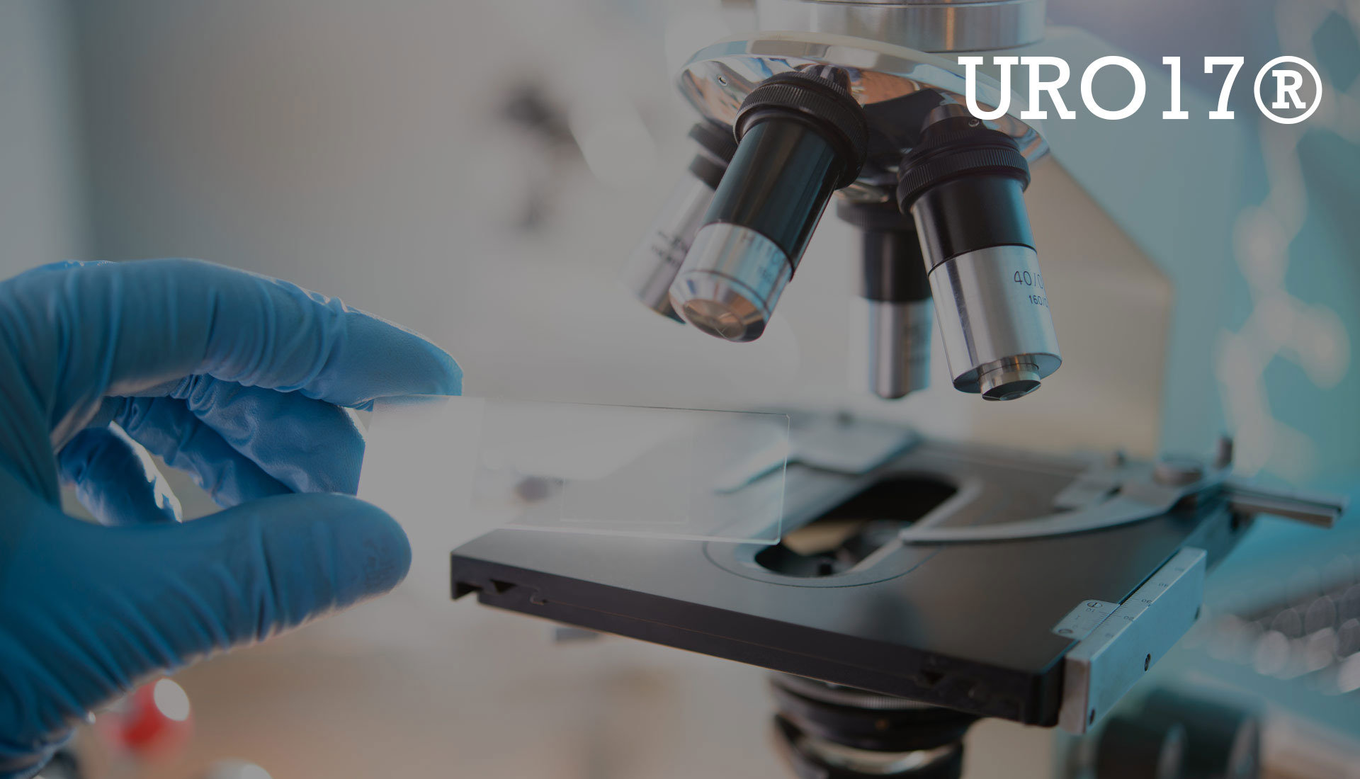 URO17 Developing a Highly Sensitive Urine Test for Bladder Cancer